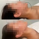 평택 여드름, 피부관리와 생활습관 트레이닝까지 해주는 로즈아트스킨 1회차 후기