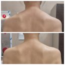 세븐일레븐 대전괴정힐링점 | 에르벨에스테틱 괴정점: 대전 바디관리 및 테라노바 등관리 후기
