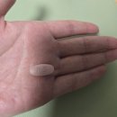 이야기약국 | 치질 수술 겁나서 약국 달려감.. 먹는 치질약 '푸레파센' 복용 찐후기