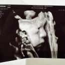 11500-6-63-28 | 임신후기증상(28,29,30,31주차) 입체초음파 몸무게 치질