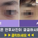뷰앤미의원 네이버블로그