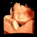 의림대로33길 | 26년 2월 끄적끄적 📝 _ 시간이 넘뭄남 빠른걸