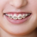 맑은플란트치과의원 이미지