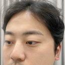 무한종합컨설팅 | 부산눈썹문신 하단눈썹문신 콤보로 받고 온 솔직한 후기(비포에프터 확실함)