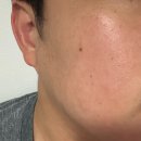 아이엘라 | 피부 속당김과 붉은기 동시 케어 - 아이엘라 PDRN 병풀 릴리프 토너 후기