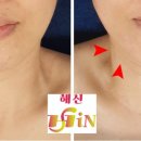 해신스킨케어 네이버블로그