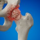 양재마디튼튼의원 이미지