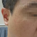 겨드랑이 및 흑꿈치해결을 위한 르샤인미 프로테아제 논착색크림 후기