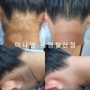 아나덴슈가링왁싱광명철산점