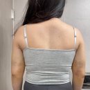 베리핏(VERY FIT) | 웨딩다이어트 부평지방분해주사 팔뚝 후기