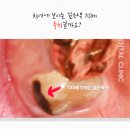주례동 치과 후기 과잉진료 안하는 양심치과 선택 기준