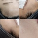대구북구재생관리 왁싱 렛미인 피부관리 재방문 대만족 후기