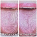 원자한의원 이미지