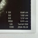 어르빛 | 임신 6주차 증상 : 작은 아기집, 피고임 원인과 유산방지제 주사 후기