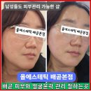 영종대로 278번길L | 배곧 피부관리 올에스테틱 배곧점에서 얼굴 라인 정돈 윤곽관리 후기
