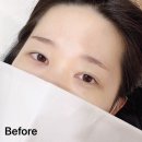 아침 눈썹 스트레스 탈출 야당 제이럽뷰티 눈썹 반영구 후기