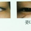 연세브라이튼안과의원 이미지