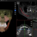 편한치과의원 | 전주 임플란트 고민 끝! 자인치과의원 리얼 후기 (인후동 치과 추천)