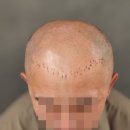 보임컨설팅 네이버블로그