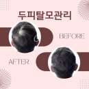 김나연스킨케어 네이버블로그