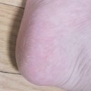 멀티소프트 | [리뷰] 소프트 크로스 멀티 케어 풋 크림 사용후기 : 우레아(Urea) 성분 함유로 발 각질 부드럽게