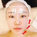 양주피부관리 [클라온에스테틱] 맞춤형 피부관리 방문 후기