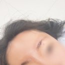 보니움 이미지