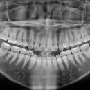 사랑니를부탁해구강악안면외과치과의원 이미지