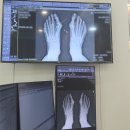 연세건우병원 | [족부 전문]연세건우병원 무지외반증 상담 및 비용(최소침습수술 MICA)후기, 수술도 잡음!