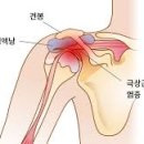 엑스(x)휘트니스 이미지