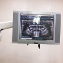 비에스치과의원 | [교정] 비에스치과교정과 치과의원 :: 내돈내한 치아교정 후기/1년 6개월 비발치 세라믹 교정