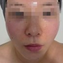 은아아파트(창원시청방면) | 창원 윤곽관리 후기｜끌리메 창원점 작은얼굴관리 체험 솔직후기