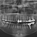 거성치과기공소 이미지