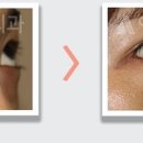 앤써성형외과의원 이미지