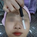민성형외과피부과 네이버블로그