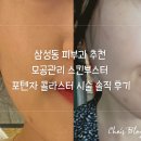 삼성밴스의원 | 삼성동피부과 추천 모공관리 스킨부스터 포텐자 콜라스터 시술 솔직 후기