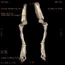 죽백동 소로 3-74 | [Case Study] 강아지 양측 전지 각변형·회전변형, 3D 계획 교정 절골술과 금속판 내고정술