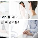 예라인의원 | 미금역피부과 여드름 겪고 난 후 관리는?