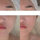 마음의 양식 | 옥정리프팅 피부관리 뷰티온 올인원리프팅 관리 후기