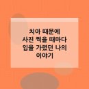 서울오케이치과의원평택점 | 치아 때문에 사진 찍을 때마다 입을 가렸던 나의 이야기