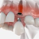 불당본점서울비디치과의원 이미지