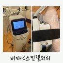 비타씨(c)스킨갤러리 | 간석동 피부관리 다이어트로 비타c스킨갤러리, 냉동 지방 분해술 관리 후기