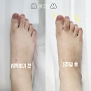 손태석 발가락운동용구 | 내몸을 위한 발교정 1주일 변화 및 후기(feat.손태석발가락운동용구)