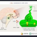 파킨슨병 진단비 진단확진 받으면 보험금 받을 수 있는지 여부 이미지