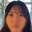 새무지개약국 | 일기 2탄] 내가 쌍수를 한 이유.. 쌍수 일주일 차 후기 들려드려요 - 광고 ❌ 대가 1도 없는 100...