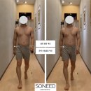 소니드체형교정센터