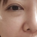 뷰티플 미백앰플 미백&amp;탄력 관리 풀세트(글로우샷&amp;르리프트+리필 세트) 40대 기미에 좋은 화장품추천