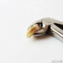 문치과의원 네이버블로그