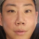 리엔장의원 | 리엔장의원(목동점) 리프테라2 6천샷 후기