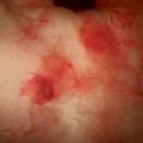 전립상회 이미지